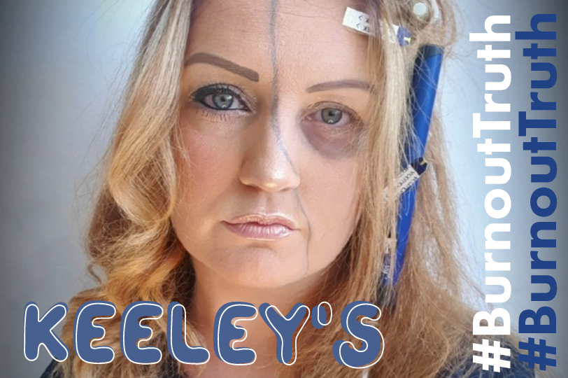 #BurnoutTruth: Keeley's Story (T1D mum) | Diabetes Community Stories Glucology 